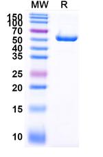 PLAC1 Recombinant Human Monoclonal Antibody (SAA2073)