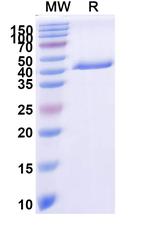 Tau Recombinant Human Monoclonal Antibody (KW1)