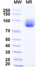 CCL3 Recombinant Human Monoclonal Antibody (Iv0078)