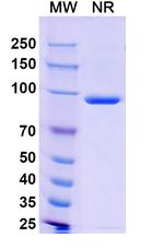 Poliovirus VP1 Recombinant Human Monoclonal Antibody (19B)