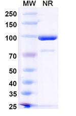 CD254 (RANK Ligand) Recombinant Mouse Monoclonal Antibody (7C6)