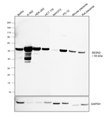 SESN2 Antibody in Western Blot (WB)