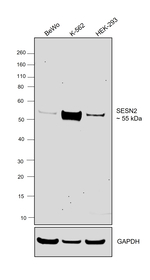 SESN2 Antibody in Western Blot (WB)