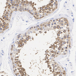 DDX4 Antibody in Immunohistochemistry (Paraffin) (IHC (P))