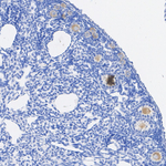 DDX4 Antibody in Immunohistochemistry (Paraffin) (IHC (P))