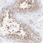LKB1 Antibody in Immunohistochemistry (Paraffin) (IHC (P))