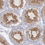 LKB1 Antibody in Immunohistochemistry (Paraffin) (IHC (P))