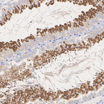 LKB1 Antibody in Immunohistochemistry (Paraffin) (IHC (P))