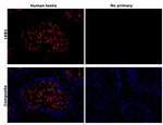 LKB1 Antibody in Immunohistochemistry (Paraffin) (IHC (P))