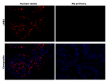 LKB1 Antibody in Immunohistochemistry (Paraffin) (IHC (P))