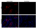 LKB1 Antibody in Immunohistochemistry (Paraffin) (IHC (P))