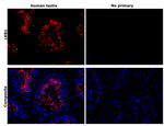 LKB1 Antibody in Immunohistochemistry (Paraffin) (IHC (P))