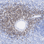 LCK Antibody in Immunohistochemistry (Paraffin) (IHC (P))