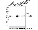 LCK Antibody in Western Blot (WB)