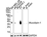 TRPML1 Antibody in Western Blot (WB)