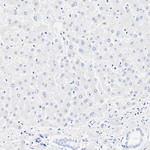 DNAJC6 Antibody in Immunohistochemistry (Paraffin) (IHC (P))