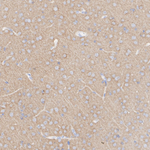 DNAJC6 Antibody in Immunohistochemistry (Paraffin) (IHC (P))