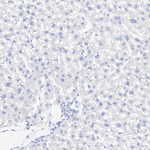 DNAJC6 Recombinant Rabbit Monoclonal Antibody (PSH07-95)