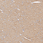 DNAJC6 Antibody in Immunohistochemistry (Paraffin) (IHC (P))