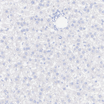 DNAJC6 Antibody in Immunohistochemistry (Paraffin) (IHC (P))