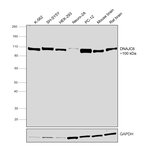DNAJC6 Antibody in Western Blot (WB)