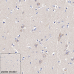 Phospho-GCN2 (Thr899) Antibody in Immunohistochemistry (Paraffin) (IHC (P))