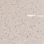 Phospho-GCN2 (Thr899) Antibody in Immunohistochemistry (Paraffin) (IHC (P))