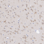 Phospho-GCN2 (Thr899) Antibody in Immunohistochemistry (Paraffin) (IHC (P))