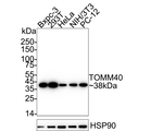 TOMM40 Antibody in Western Blot (WB)