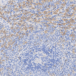 SLP76 Antibody in Immunohistochemistry (Paraffin) (IHC (P))