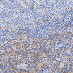 SLP76 Antibody in Immunohistochemistry (Paraffin) (IHC (P))