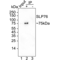 SLP76 Antibody in Immunoprecipitation (IP)