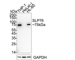 SLP76 Antibody in Western Blot (WB)