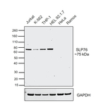 SLP76 Antibody in Western Blot (WB)