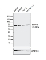 SLP76 Antibody in Western Blot (WB)