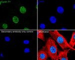 Cyclin T1 Antibody in Immunocytochemistry (ICC/IF)