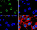 Cyclin T1 Antibody in Immunocytochemistry (ICC/IF)