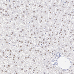 Cyclin T1 Antibody in Immunohistochemistry (Paraffin) (IHC (P))