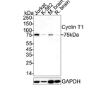 Cyclin T1 Antibody in Western Blot (WB)