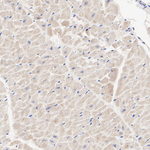 AS160 Antibody in Immunohistochemistry (Paraffin) (IHC (P))