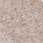 AS160 Antibody in Immunohistochemistry (Paraffin) (IHC (P))