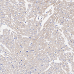 AS160 Antibody in Immunohistochemistry (Paraffin) (IHC (P))