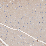 AS160 Antibody in Immunohistochemistry (Paraffin) (IHC (P))