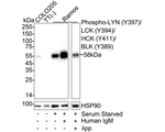 Phospho-LYN/LCK/HCK/BLK (Tyr397, Tyr394, Tyr411, Tyr389) Antibody in Western Blot (WB)