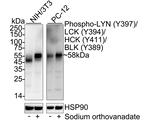 Phospho-LYN/LCK/HCK/BLK (Tyr397, Tyr394, Tyr411, Tyr389) Antibody in Western Blot (WB)