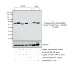 Phospho-LYN/LCK/HCK/BLK (Tyr397, Tyr394, Tyr411, Tyr389) Antibody in Western Blot (WB)