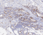 PLK1 Antibody in Immunohistochemistry (Paraffin) (IHC (P))