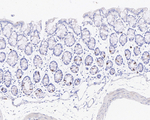 PLK1 Antibody in Immunohistochemistry (Paraffin) (IHC (P))