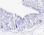 PLK1 Antibody in Immunohistochemistry (Paraffin) (IHC (P))