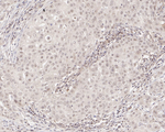 c-Abl Antibody in Immunohistochemistry (Paraffin) (IHC (P))